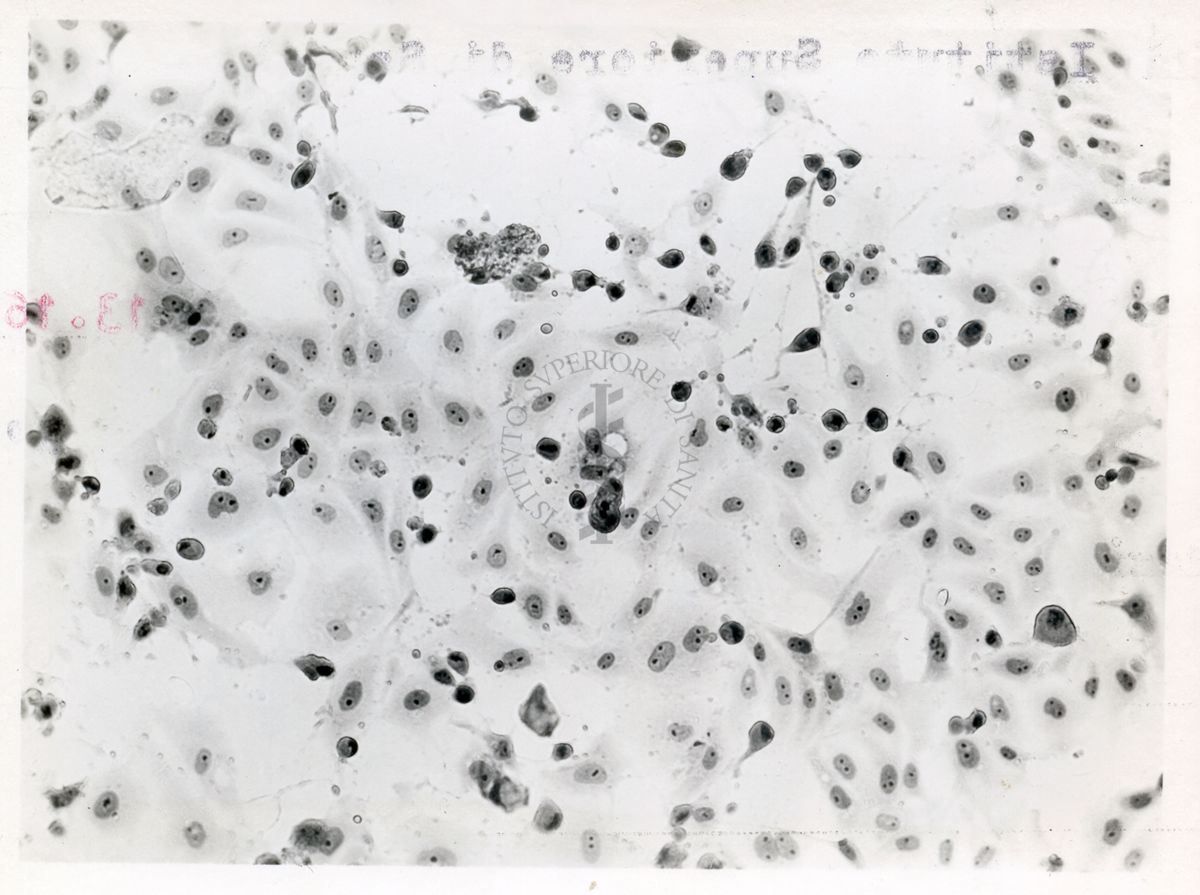 Cellule del rene di una scimmia infettate con virus ECHO di tipo 4 - Col. E.E.