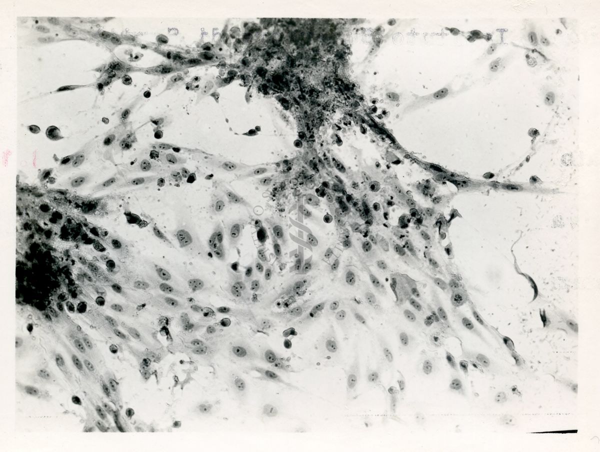 Cellule del rene di una scimmia infettate con virus ECHO di tipo 1 - Col. E.E.