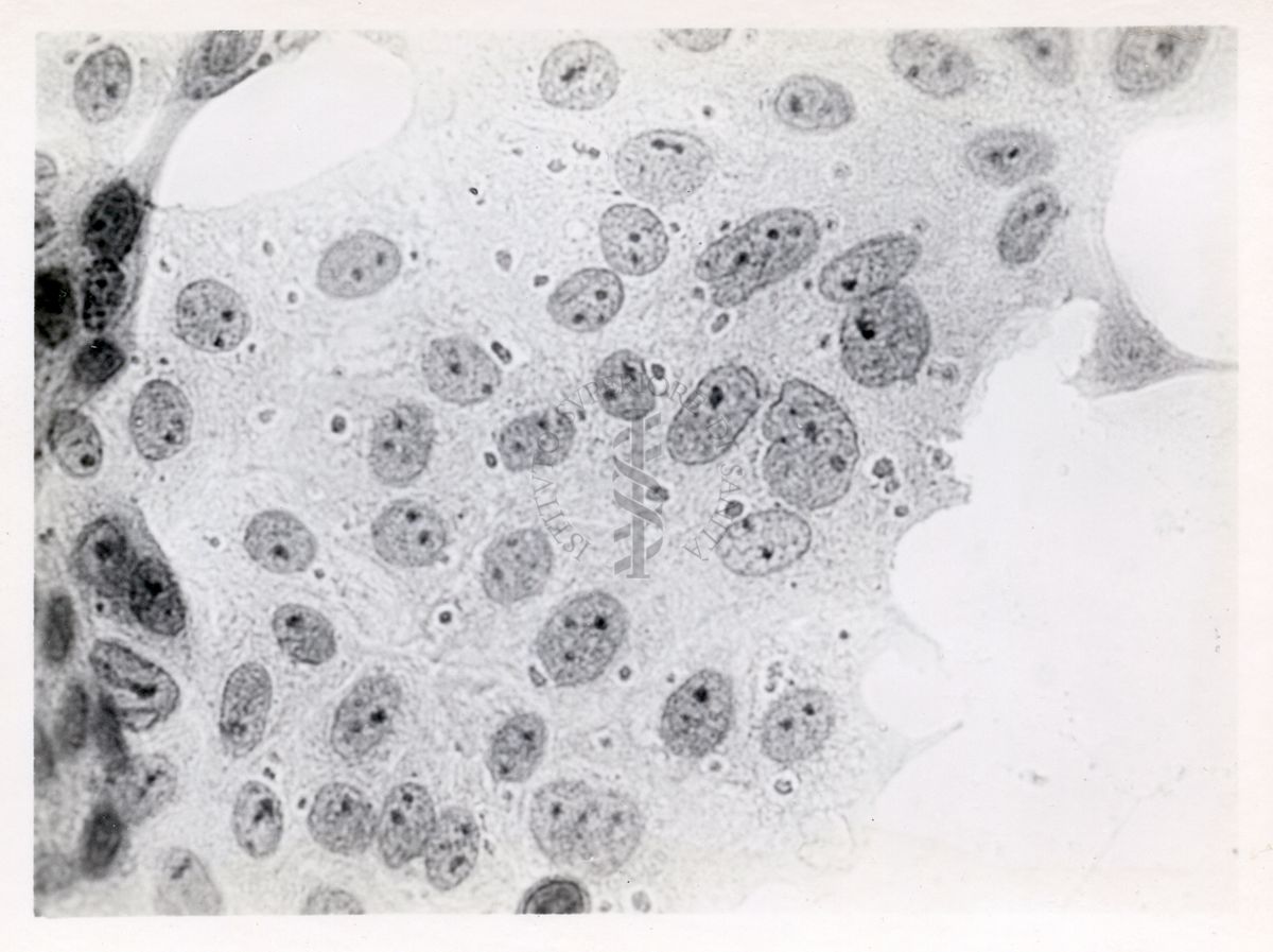 Cellule del rene di una scimmia infettate con virus del vaccino - Col. E.E.