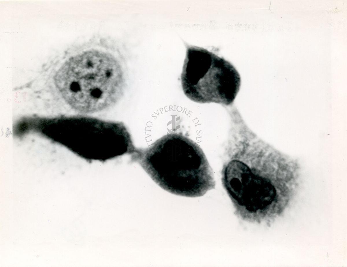 Cellule Hela infettate con virus della Poliomelite di tipo 3 - Col. E.E.