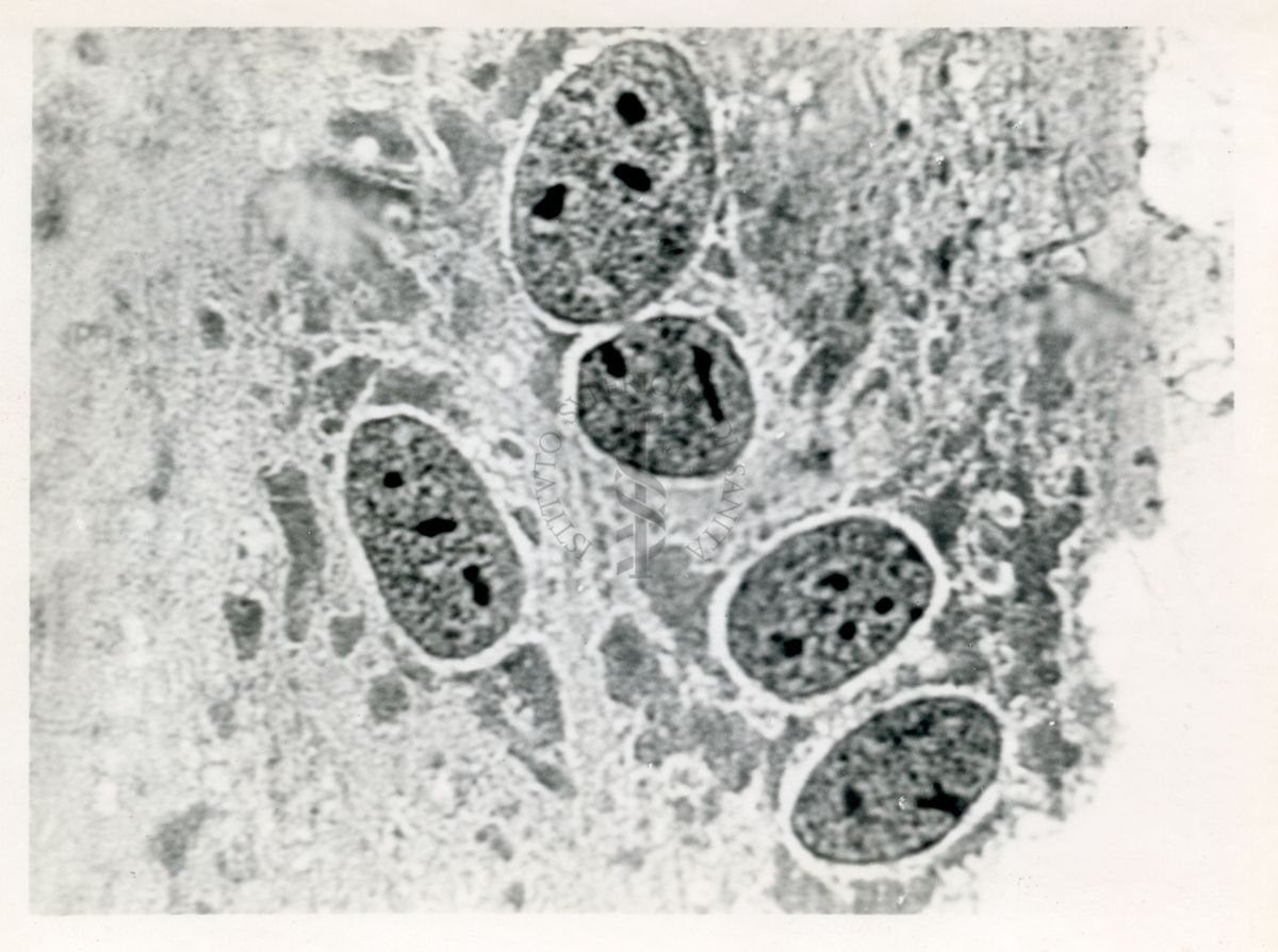 Cellule del rene di coniglio infettate con virus del vaccino - Col. E.E.