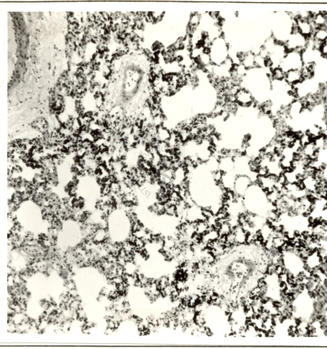 Stimolazione dei macrofagi del polmone durante la reazione di allarme del ratto