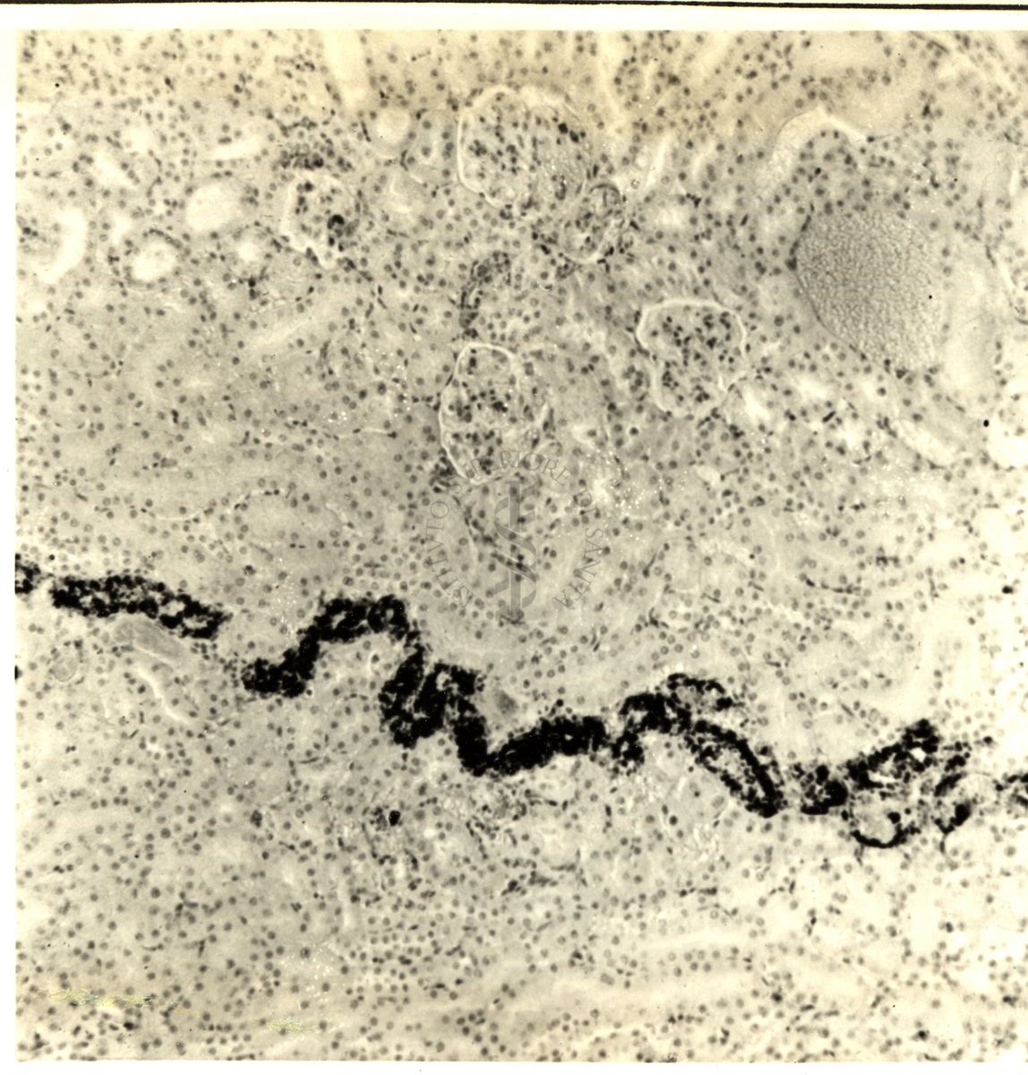 Deposizione di pigmento in un nefrone di ratto dopo trattamento con corticoidi