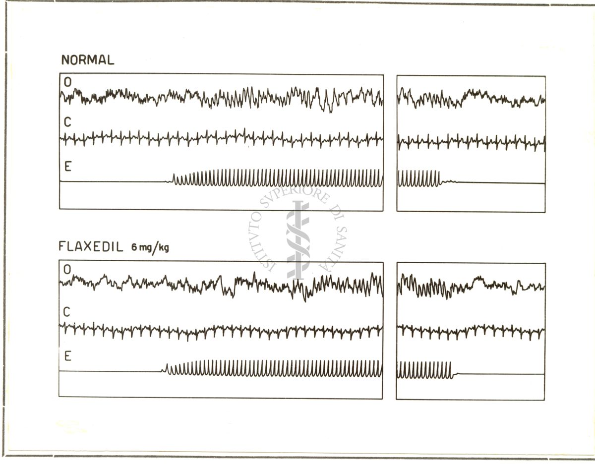 Azione del Flaxedil sull'elettroencefalogramma del coniglio prima e dopo curarizzazione