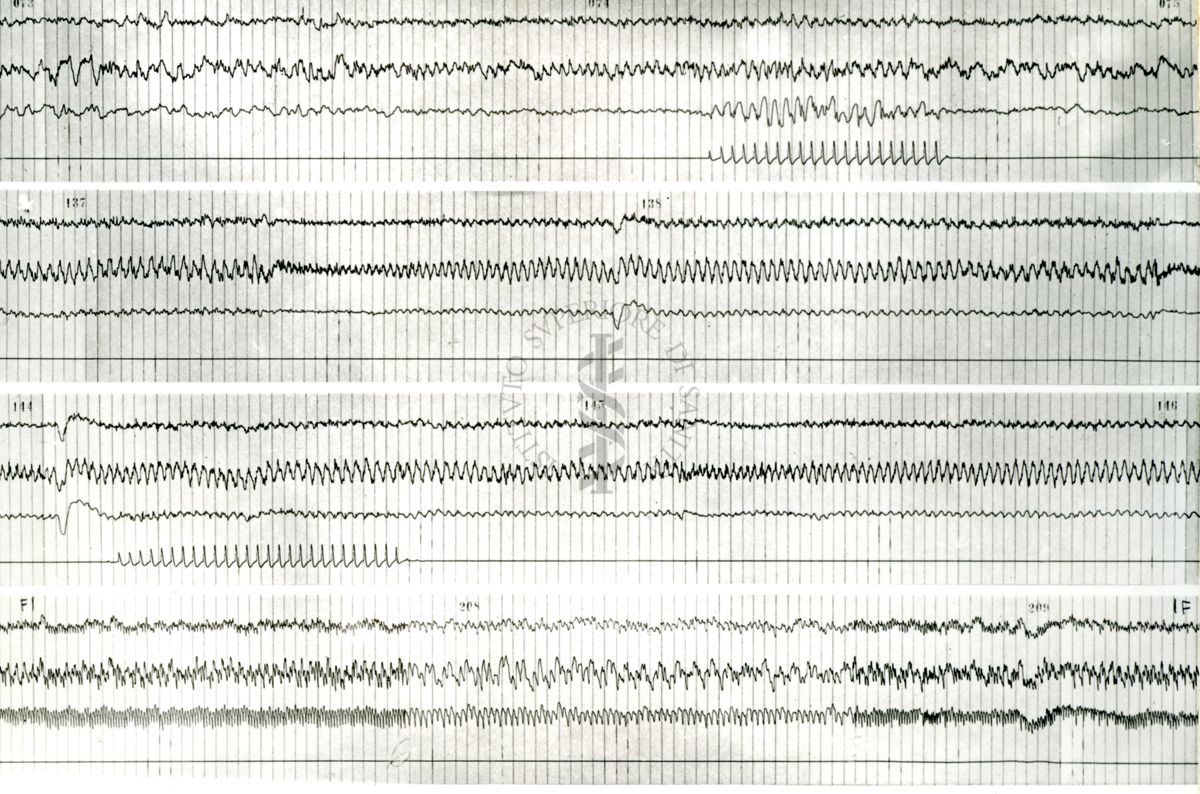 Tracciati elettroncefalografici di coniglio