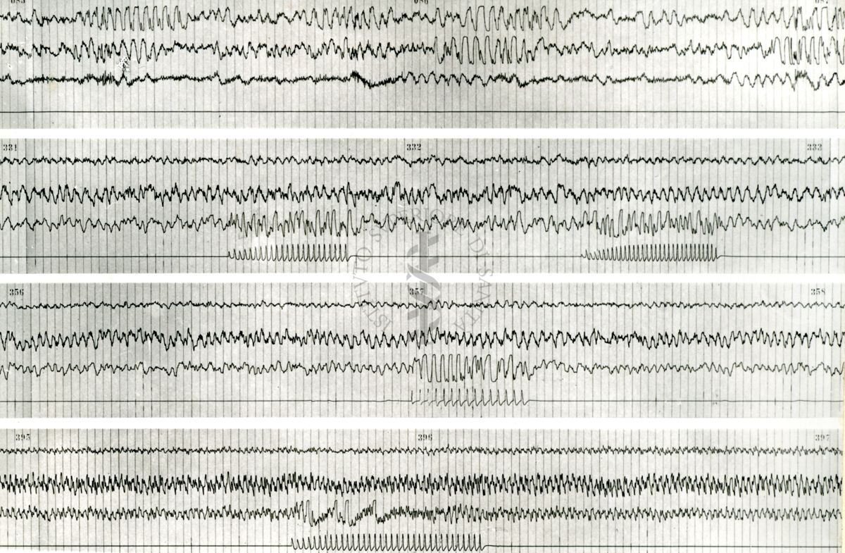 Tracciati elettroncefalografici di coniglio