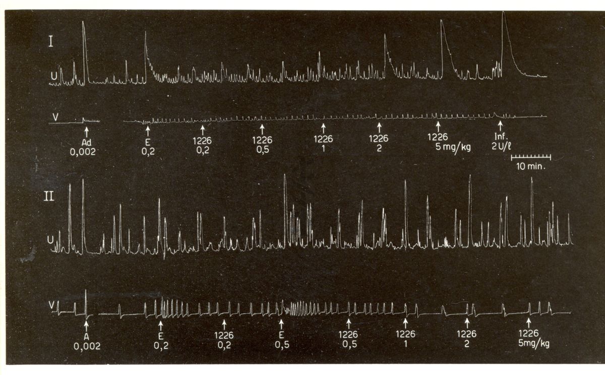 Derivati oxitocici - azione del derivato 126 I.S. in due coniglie su preparazione di uteri in situ