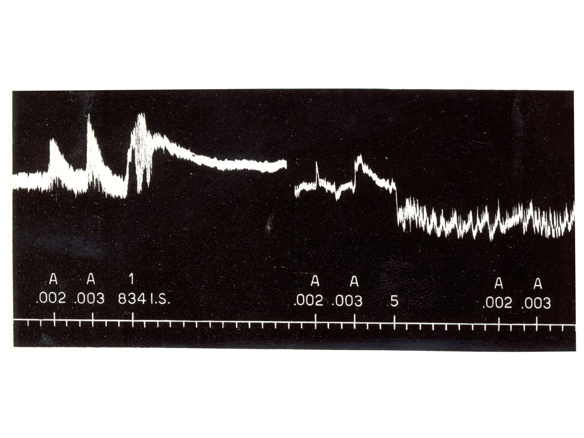 Farmaci simpatolitici - azione simpatolitica del del derivato 834 I.S. sulla pressione arteriosa del coniglio