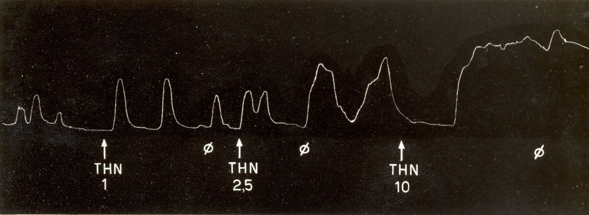 Grafico indicante l'azione oxitocica di alcuni derivati di sintesi della tetra idro naftil ammina su uteri isolati di coniglio e di cavia