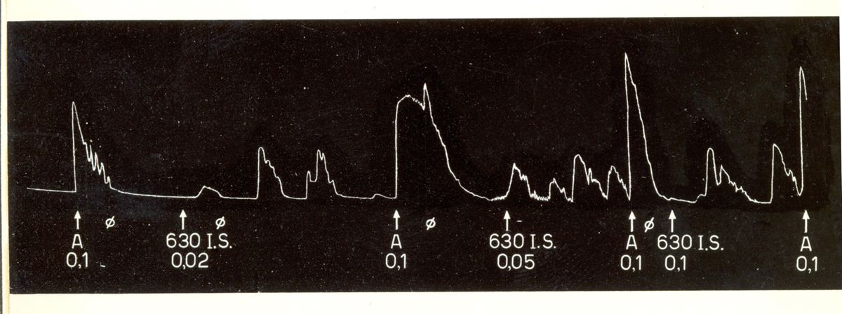 Grafico indicante l'azione oxitocica di alcuni derivati di sintesi della tetra idro naftil ammina su uteri isolati di coniglio e di cavia