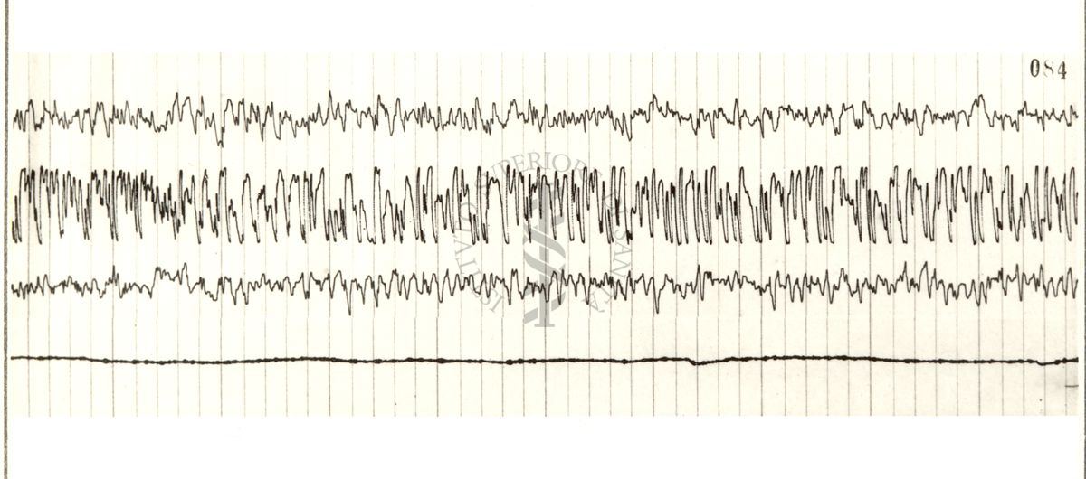 Elettroencefalogrammi di coniglio