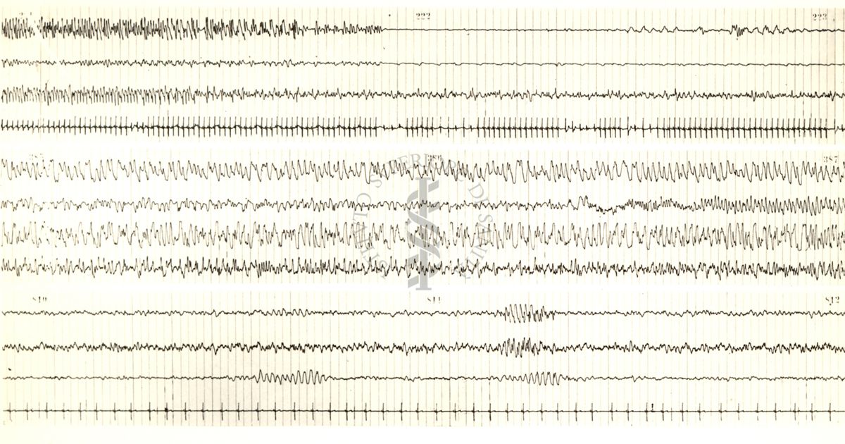 Tracciati elettroencefalografici di coniglio