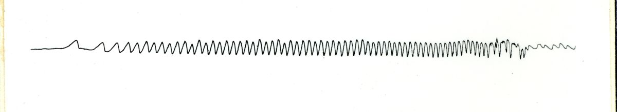 Tracciato elettronistagmografico di coniglio