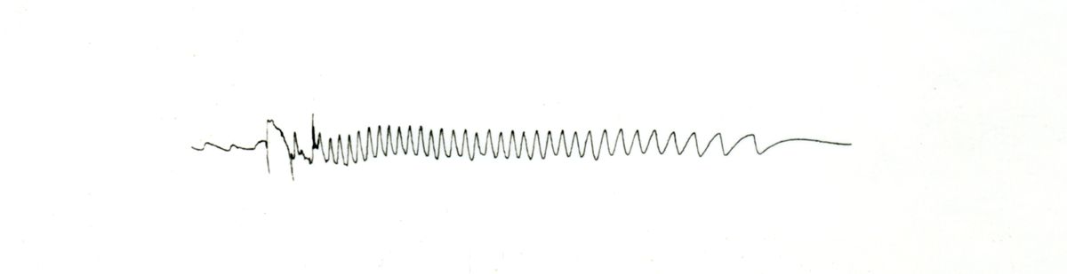 Tracciato elettronistagmografico di coniglio