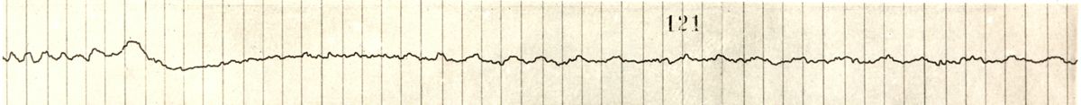 Tracciato dell'elettronistagmografico di coniglio