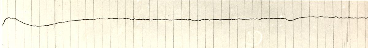 Tracciato dell'elettronistagmografico di coniglio