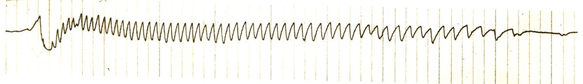 Tracciato dell'elettronistagmografico di coniglio