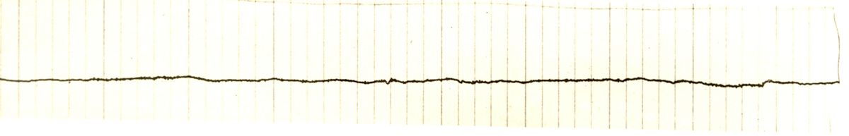 Tracciato dell'elettronistagmografico di coniglio