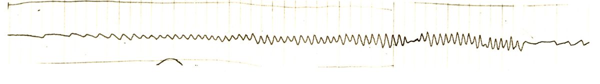 Tracciato dell'elettronistagmografico di coniglio