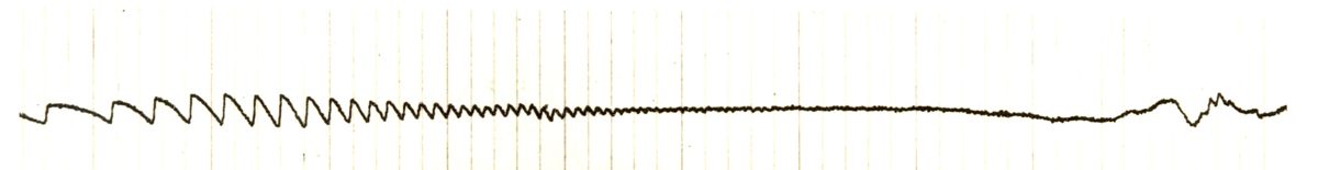 Tracciato dell'elettronistagmografico di coniglio