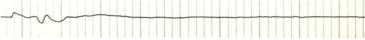 Tracciato dell'elettronistagmografico di coniglio