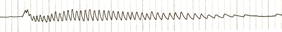 Tracciato dell'elettronistagmografico di coniglio