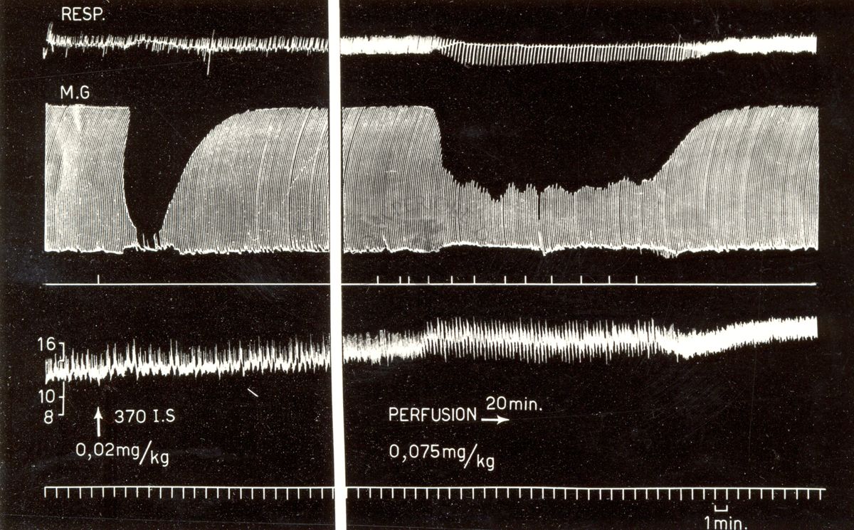 Grafici rappresentanti curari di sintesi (succinilcolina nella perfusione continua nel cane)