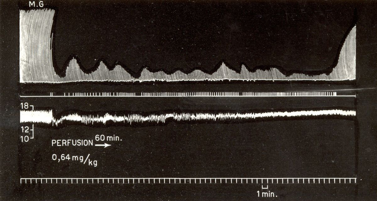 Grafici rappresentanti curari di sintesi (succinilcolina nella perfusione continua nel cane)