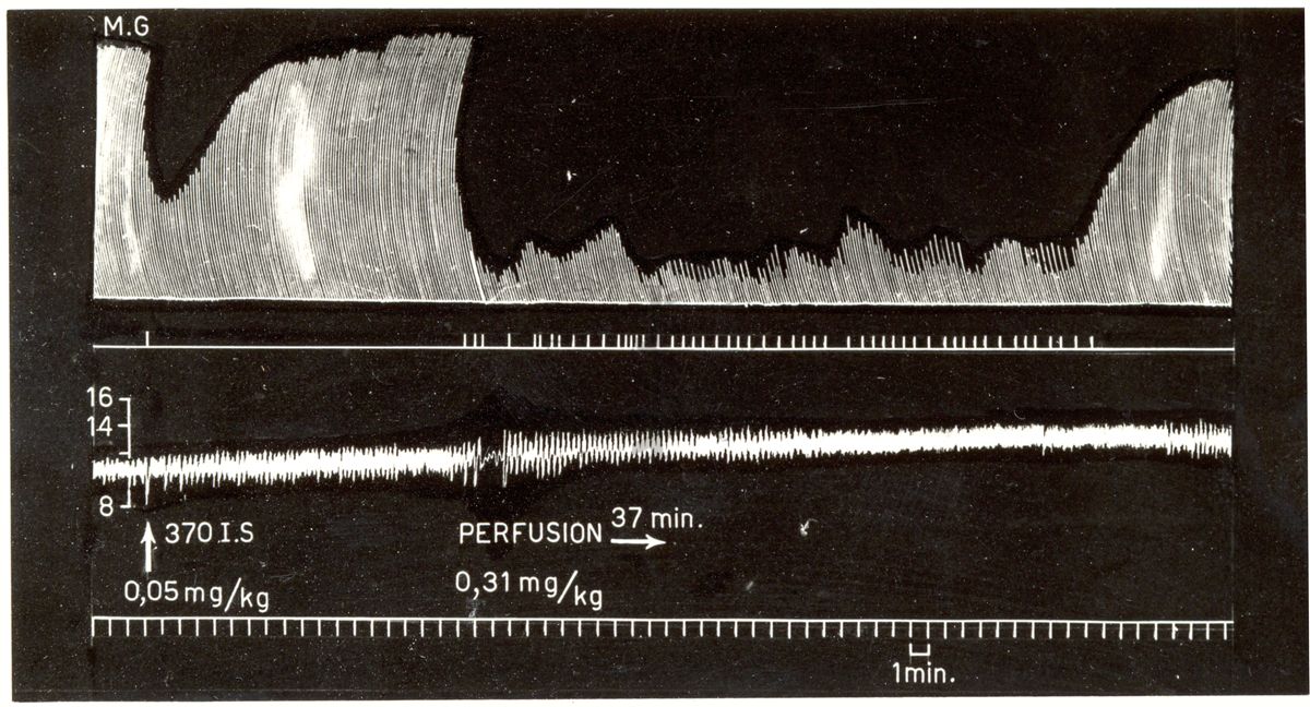 Grafici rappresentanti curari di sintesi (succinilcolina nella perfusione continua nel cane)