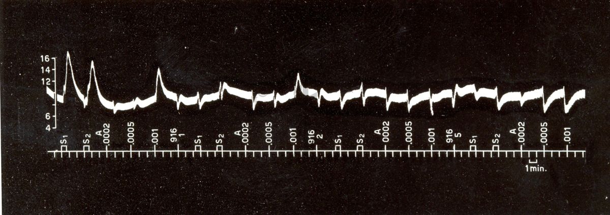 Grafici raffiguranti l'azione sulla pressione arteriosa del cane da simpatolitici di sintesi (derivati dell'ergotammina)