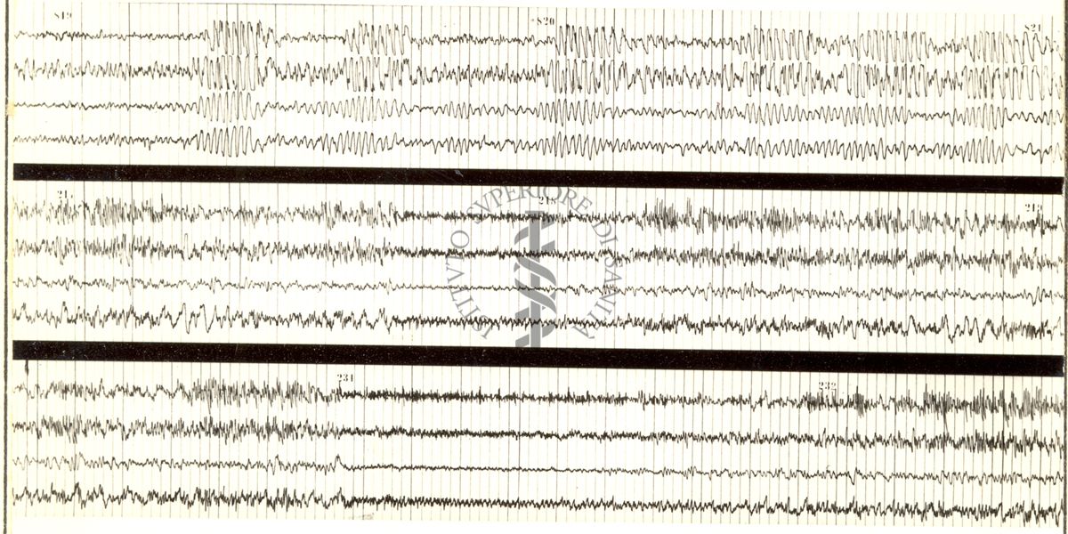 Tracciati elettroencefalografici