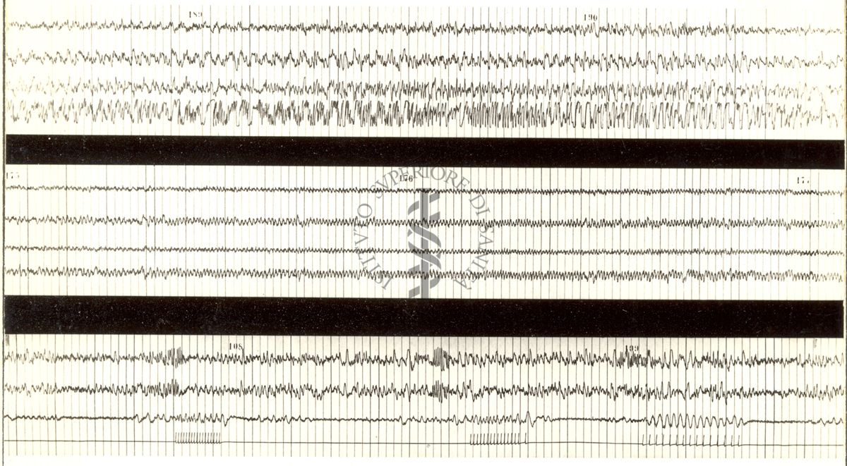 Tracciati elettroencefalografici
