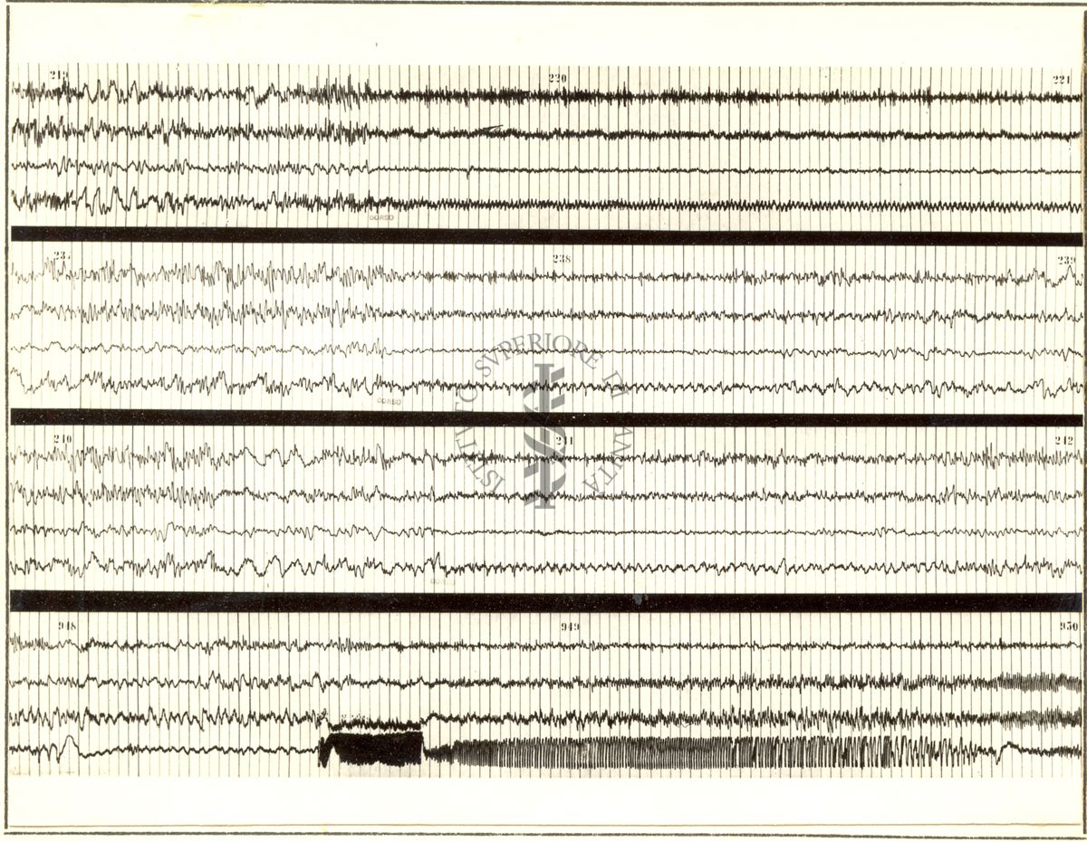 Tracciati elettroencefalografici