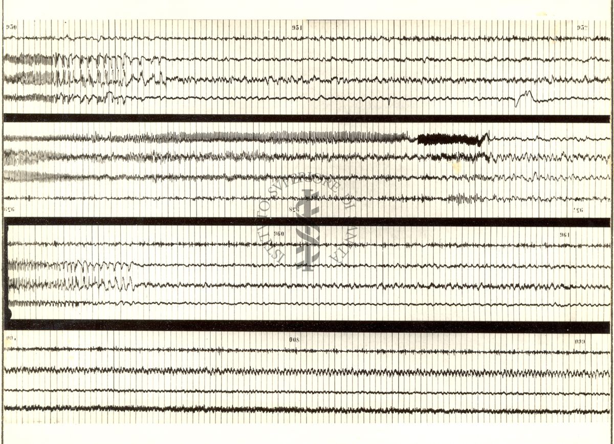 Tracciati elettroencefalografici