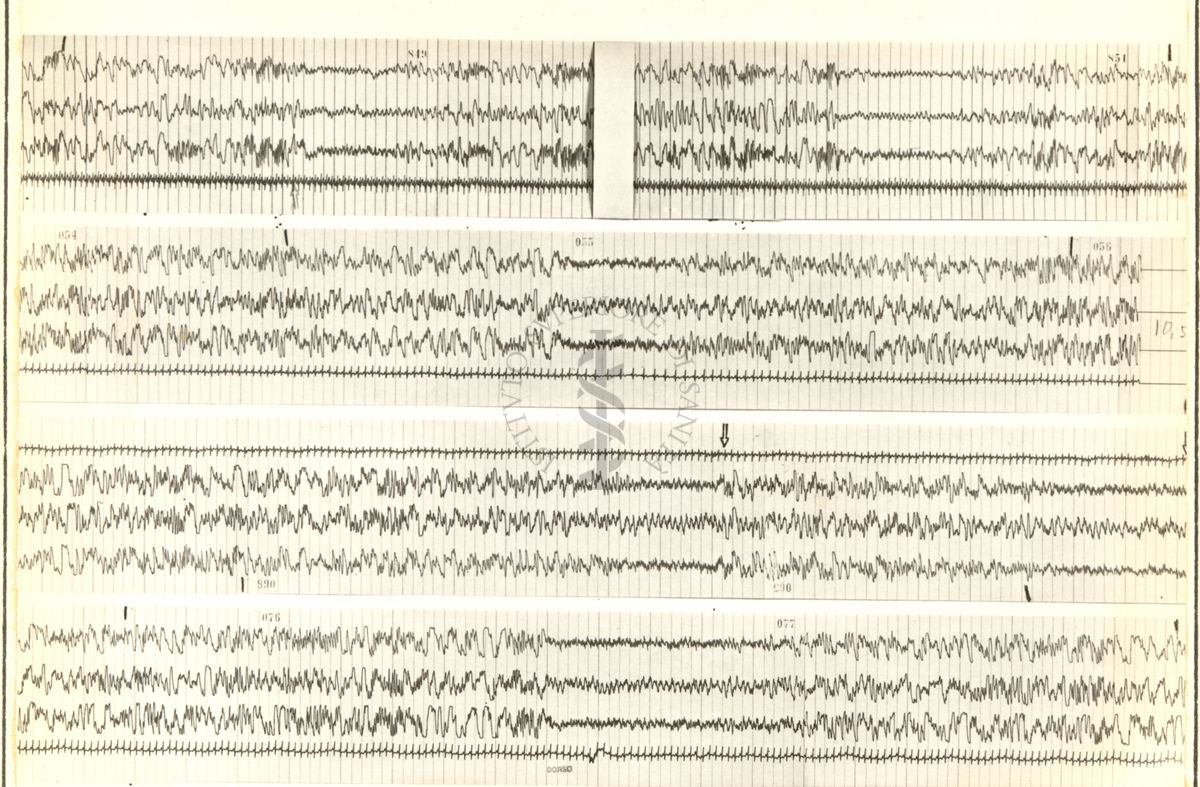 Tracciati elettroencefalografici di coniglio