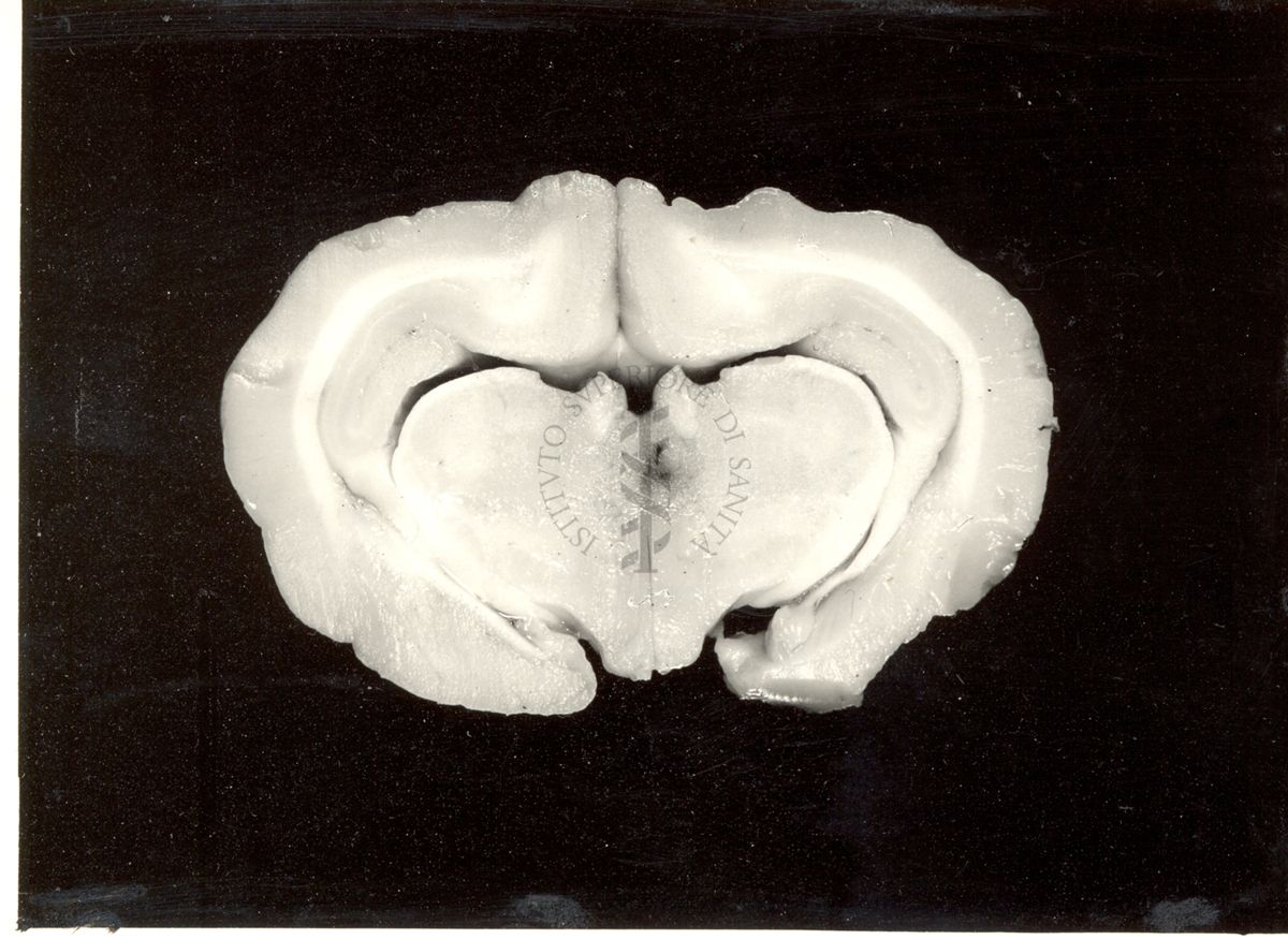 Localizzazione di lesioni endo-cerebrali in cervelli di coniglio