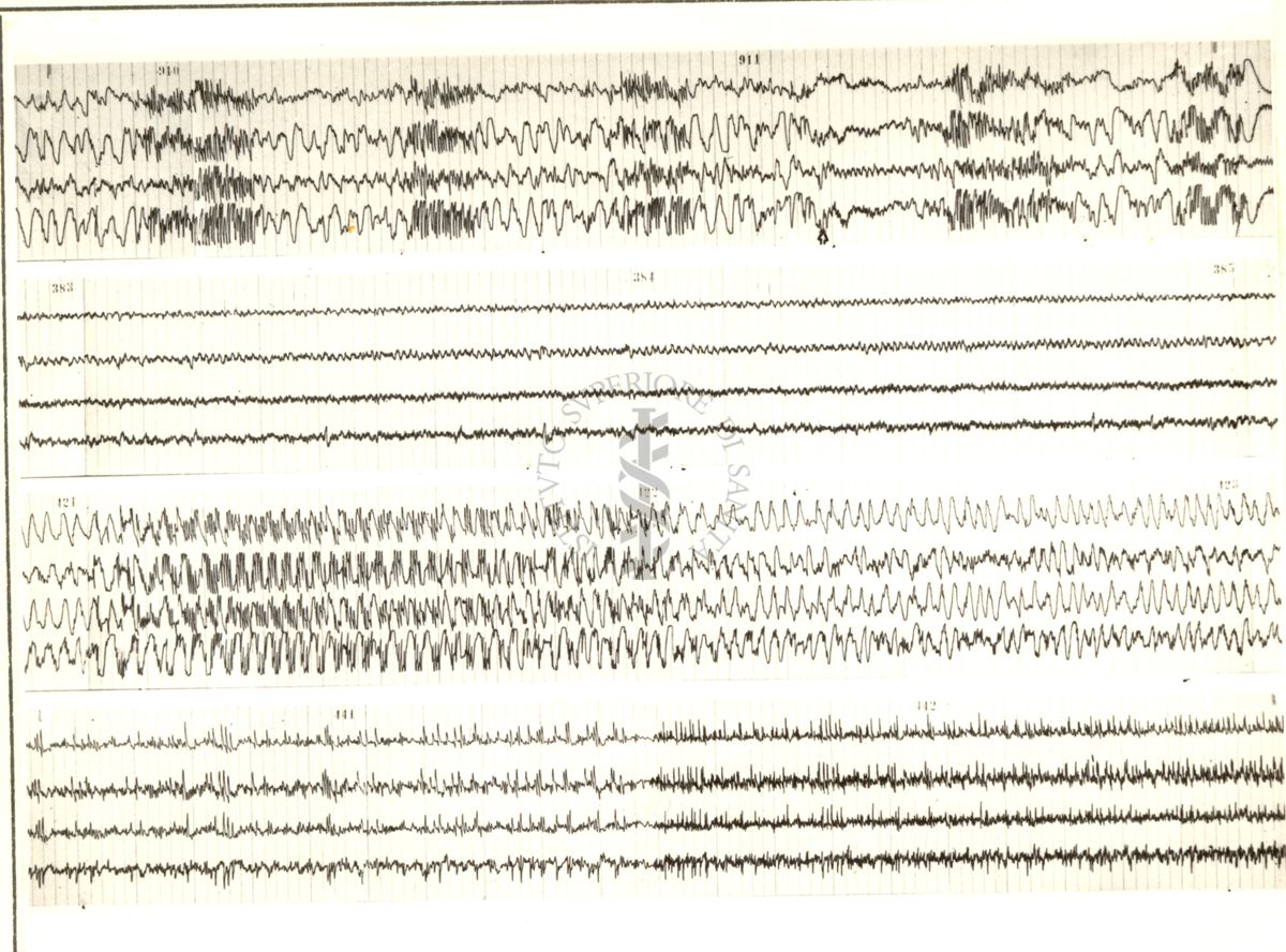 Tracciati elettroencefalografici di coniglio