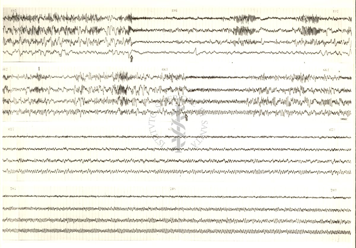 Tracciati elettroencefalografici di coniglio