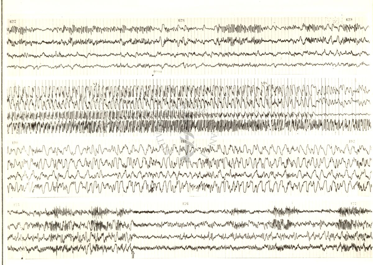 Tracciati elettroencefalografici di coniglio