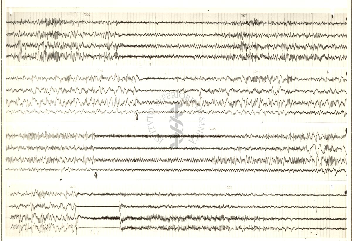 Tracciati elettroencefalografici di coniglio