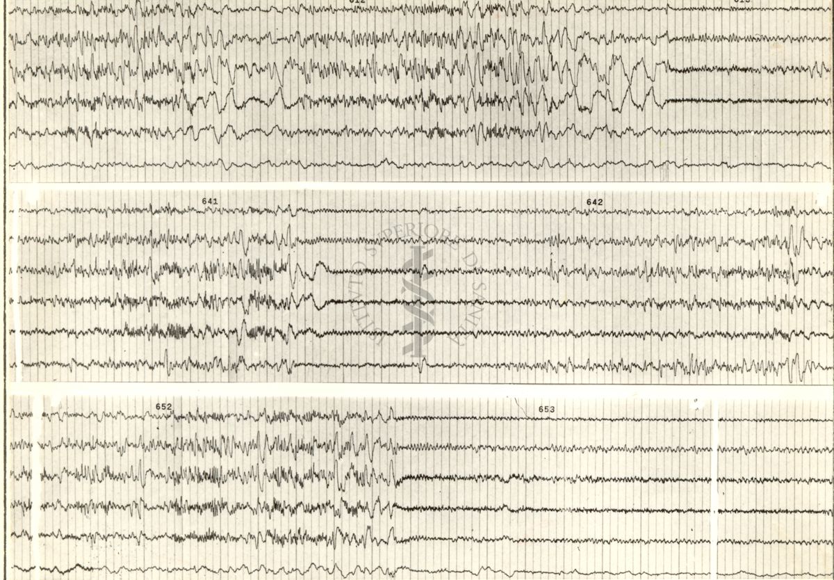 Tracciati elettroencefalografici