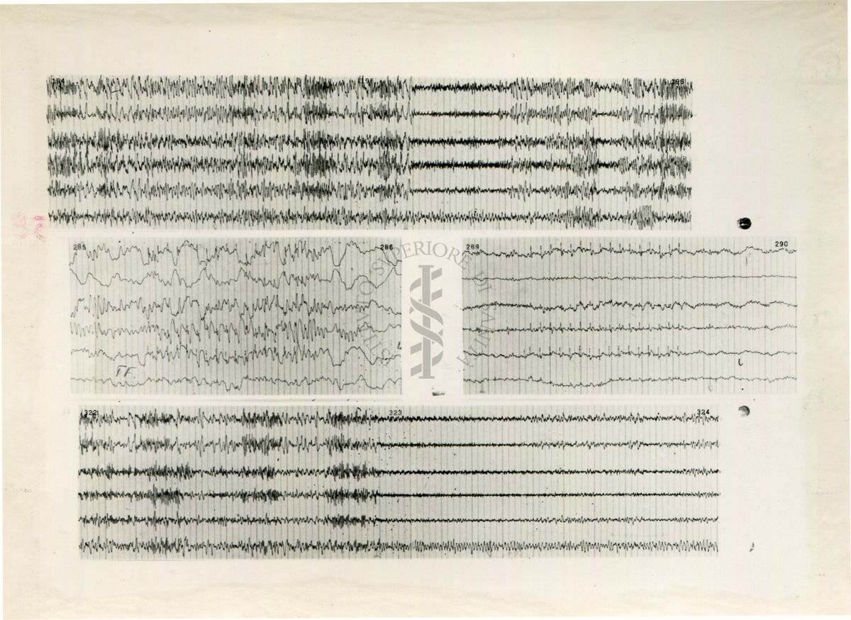 Tracciati elettroencefalografici di coniglio