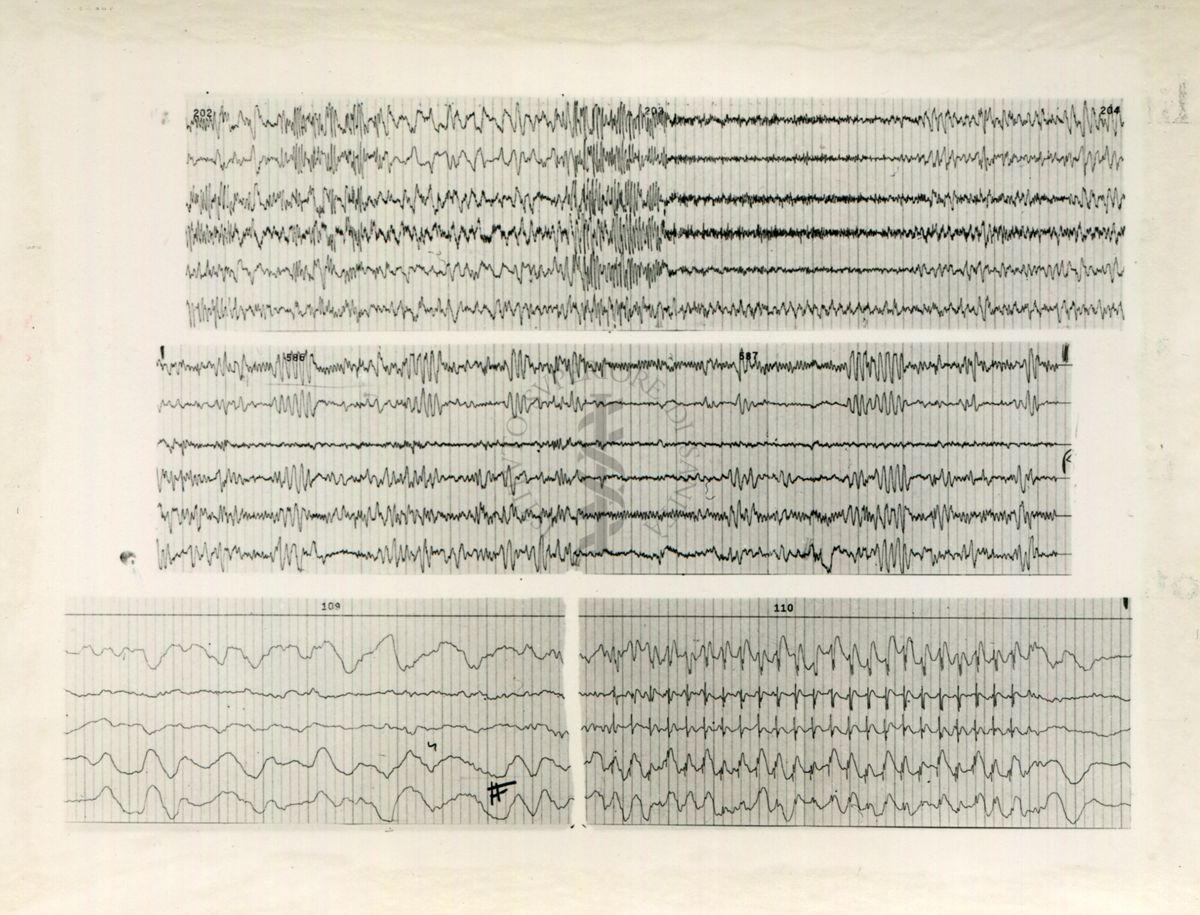 Tracciati elettroencefalografici di coniglio