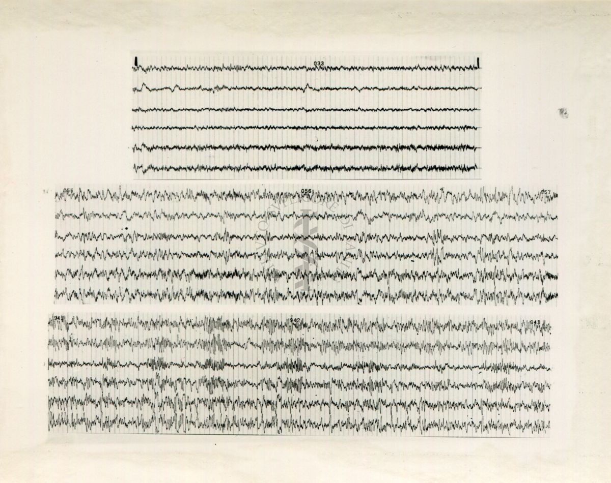 Tracciati elettroencefalografici di coniglio