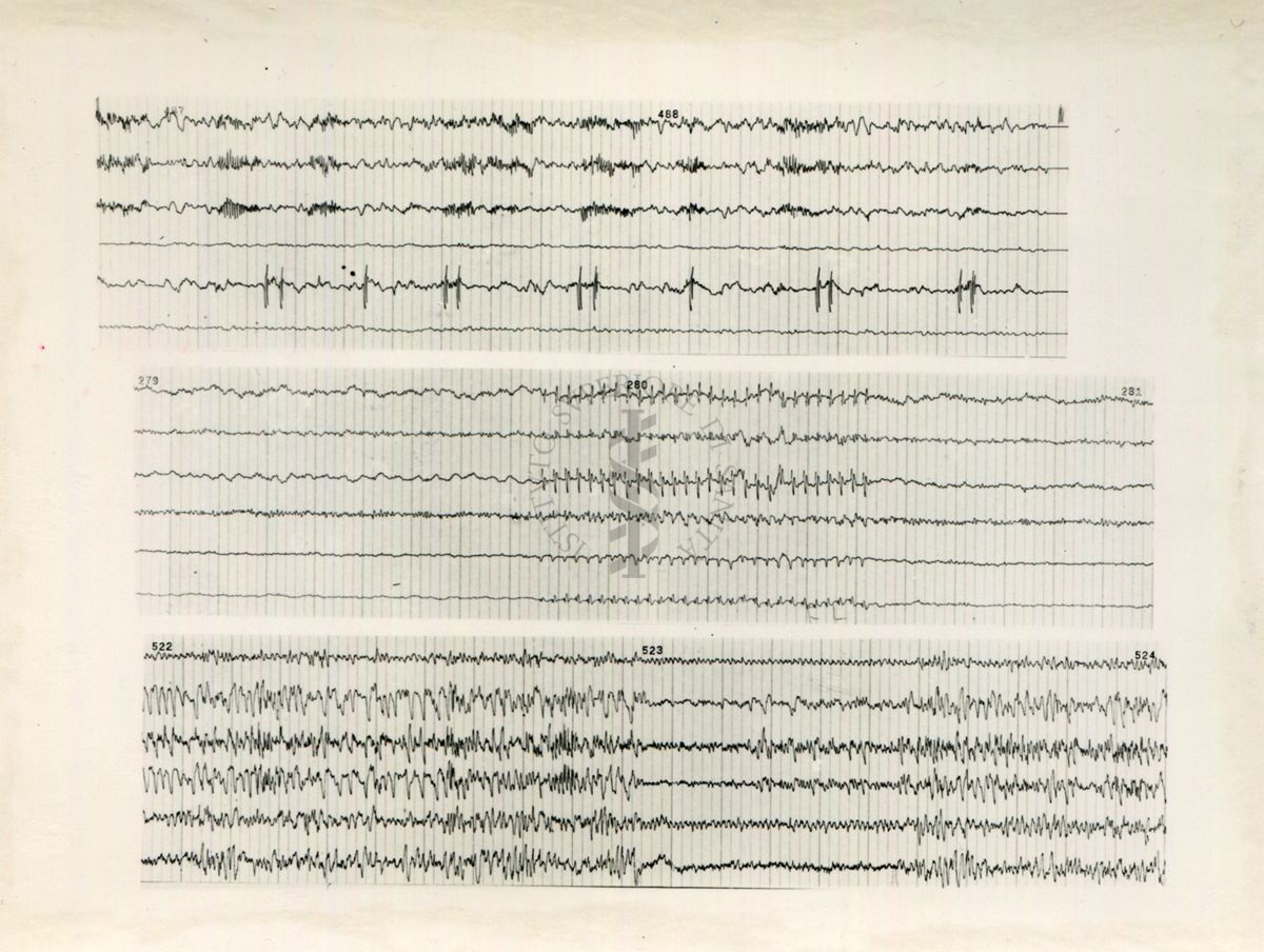 Tracciati elettroencefalografici di coniglio