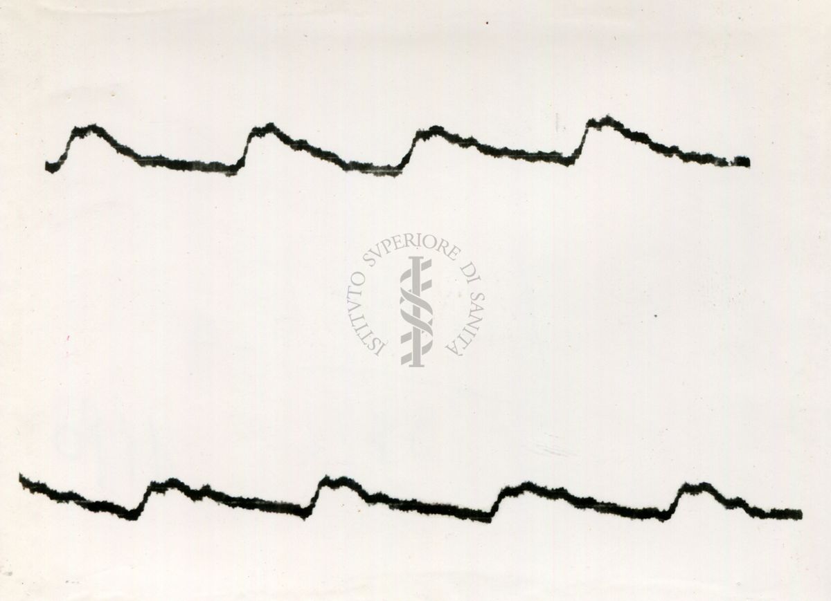 Registrazione piezografica del polso dell'arteria temporale nell'uomo sotto effetto di vari farmaci