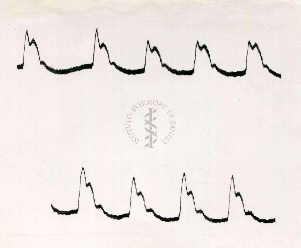 Registrazione piezografica del polso dell'arteria temporale nell'uomo sotto effetto di vari farmaci