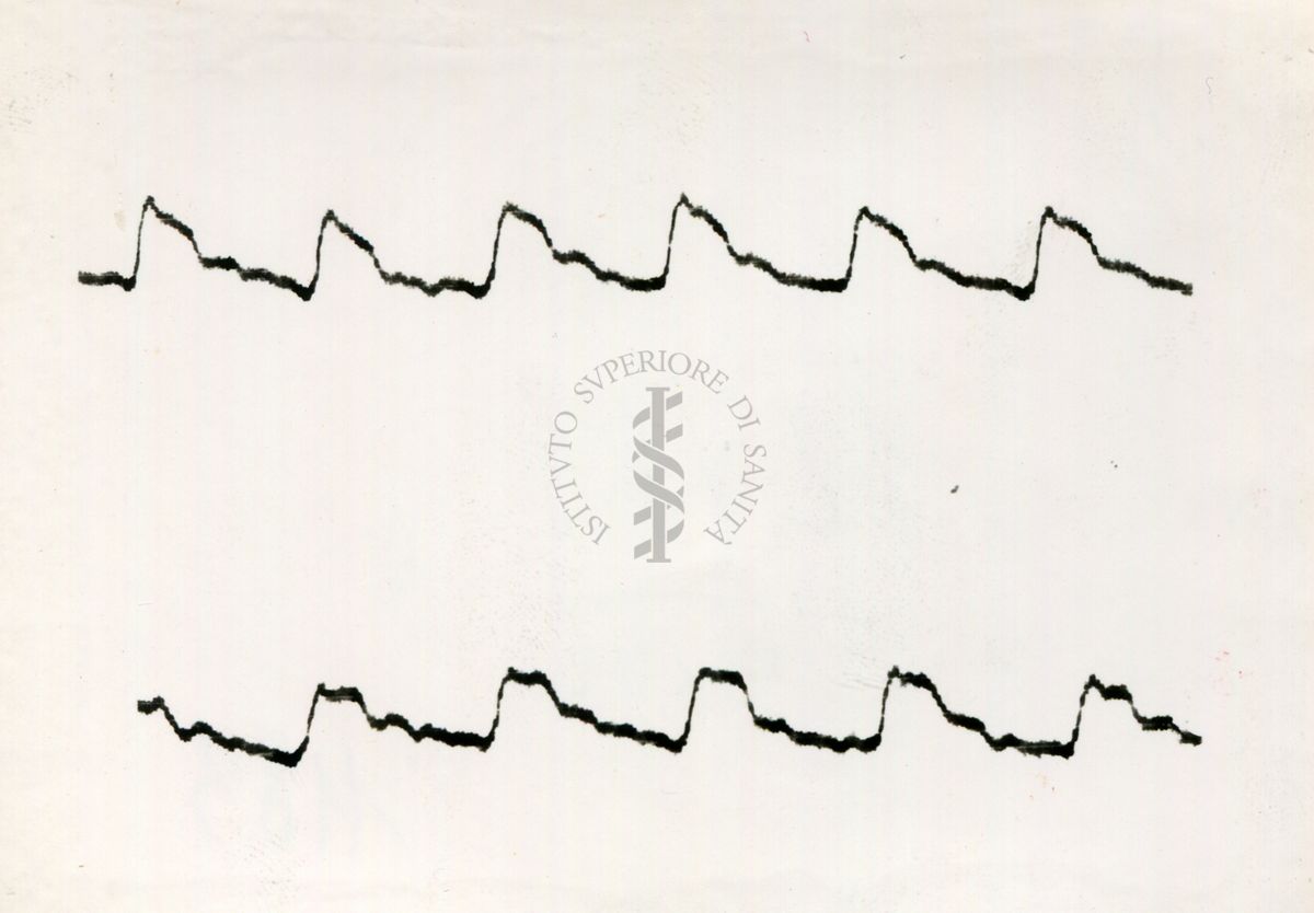 Registrazione piezografica del polso dell'arteria temporale nell'uomo sotto effetto di vari farmaci