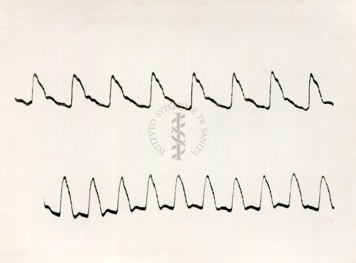 Registrazione piezografica del polso dell'arteria temporale nell'uomo sotto effetto di vari farmaci
