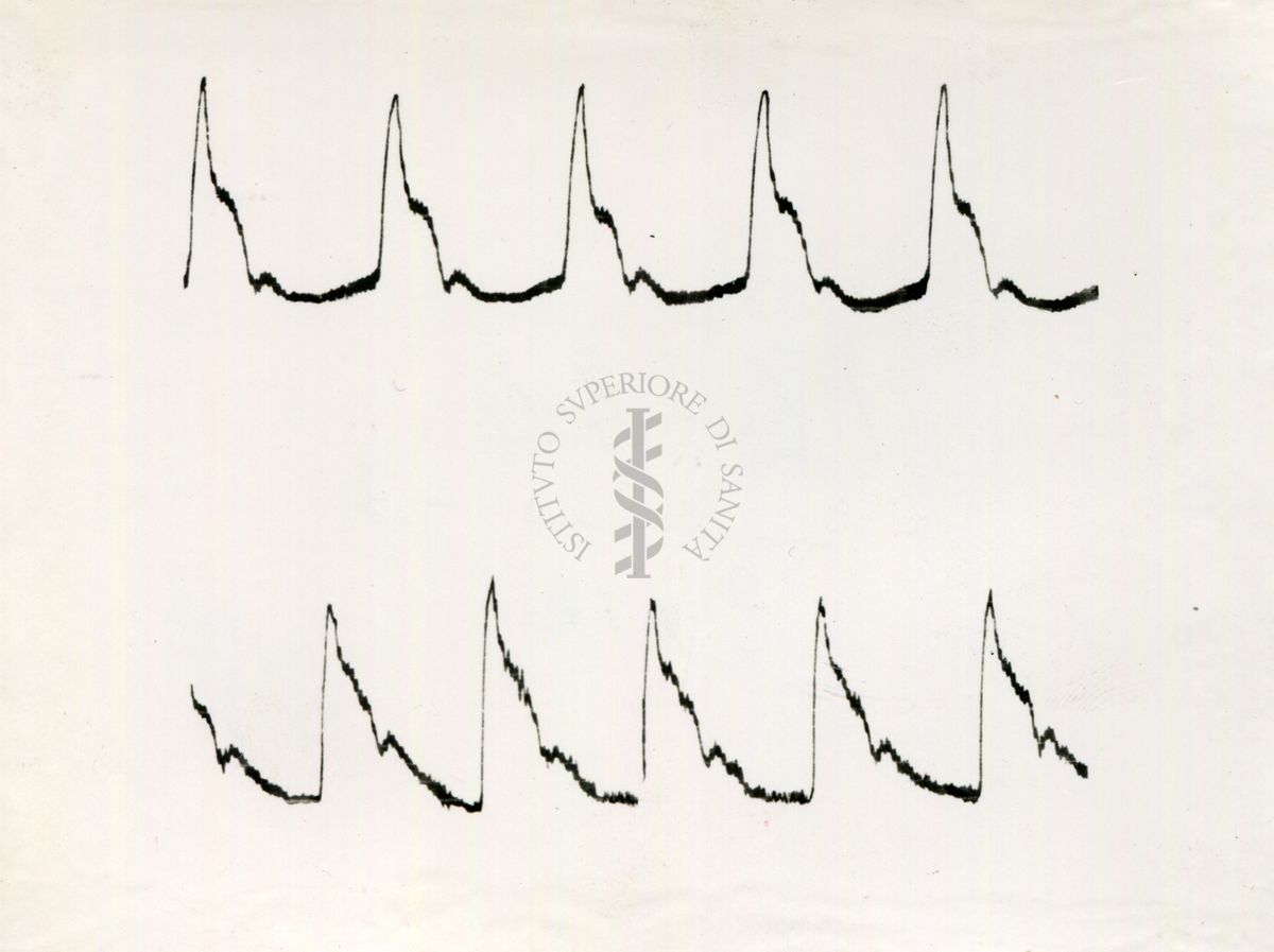Registrazione piezografica del polso dell'arteria temporale nell'uomo sotto effetto di vari farmaci